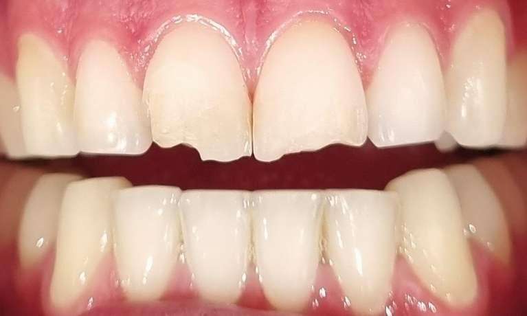 Lauren-test-Before-Image